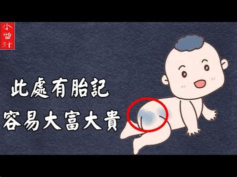 大腿胎記|【大腿胎記】大腿胎記藏著前世今生的秘密！胎記位置大解析，揭。